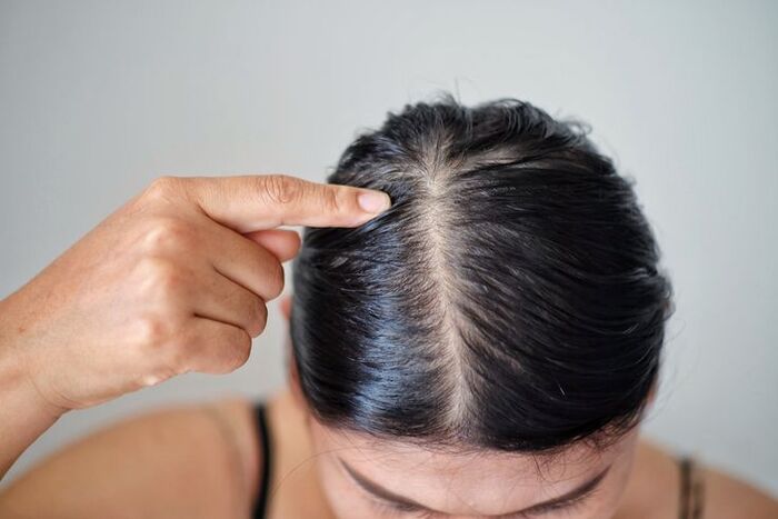4 cách chăm sóc da đầu bằng nguyên liệu tự nhiên tại nhà