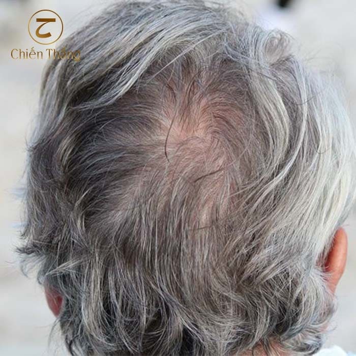 ăn gì để giảm tóc bạc sớm