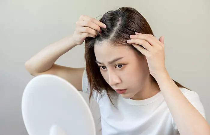 cách khắc phục hiện tượng tóc bạc sớm