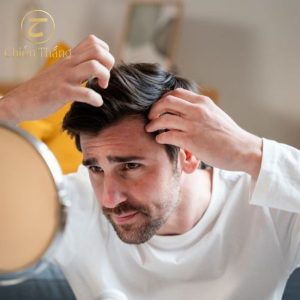 cách trị gàu cho nam