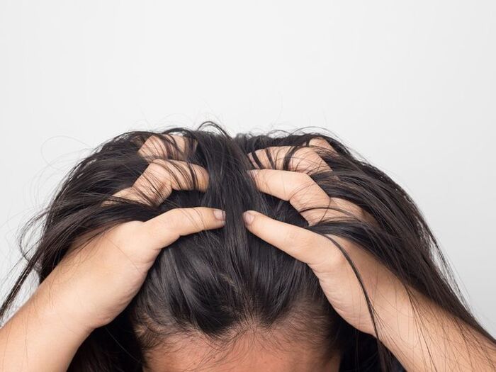 dấu hiệu nhận biết da đầu bị tổn thương