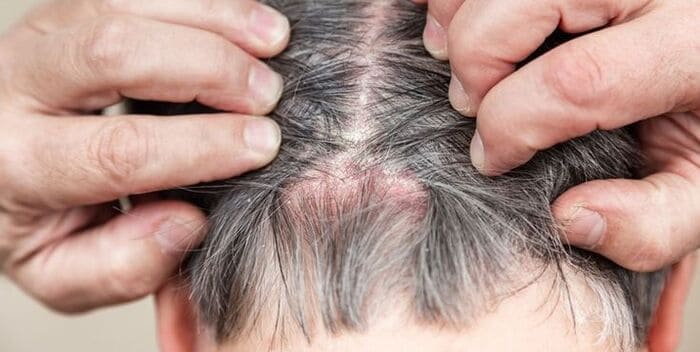 đối tượng không nên nhuộm tóc bạc
