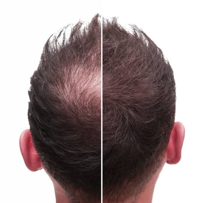 hà thủ ô trị rụng tóc