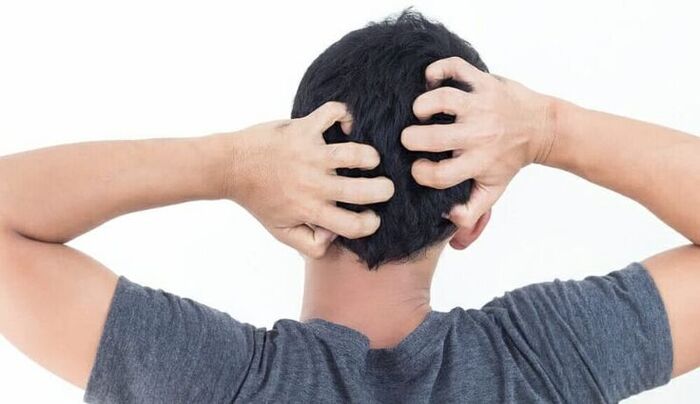 nguyên nhân dẫn đến tình trạng gàu ở nam giới