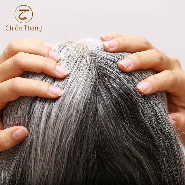 tại sao tóc bạc ngứa
