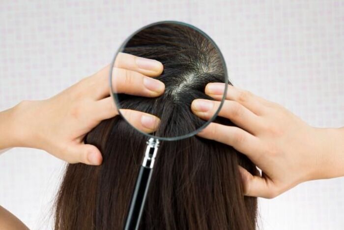 thanh nhiệt giải độc cơ thể hỗ trợ tình trạng máu xấu tóc bạc
