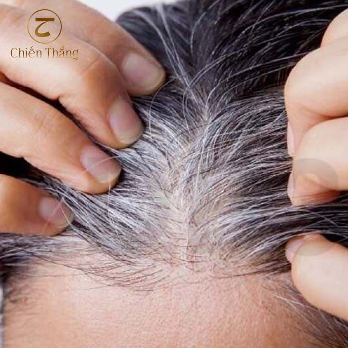 tóc bạc có nên nhuộm không