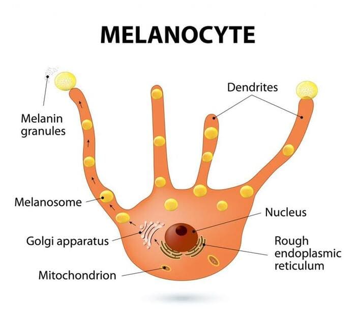 tóc bạc do thiếu hụt melanin
