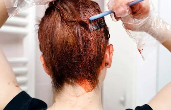 tóc bạc ngứa do dị ứng thuốc nhuộm