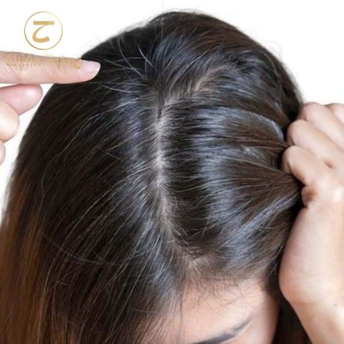 tóc bạc sớm thiếu chất gì cần bổ sung vitamin nào?