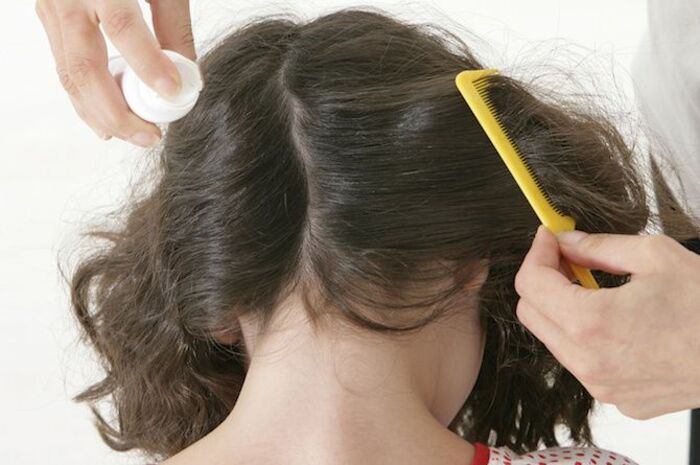 trẻ em bị tóc bạc sớm là bệnh gì