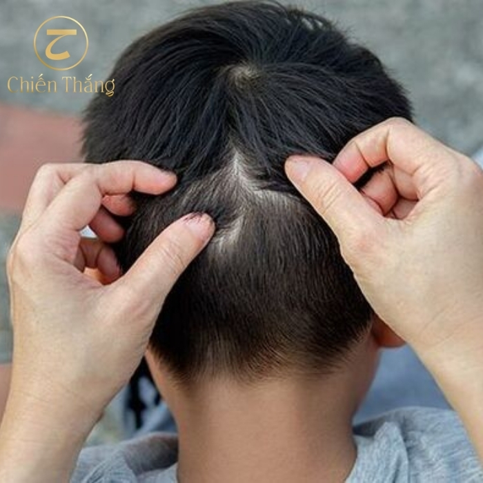 trẻ em có tóc bạc