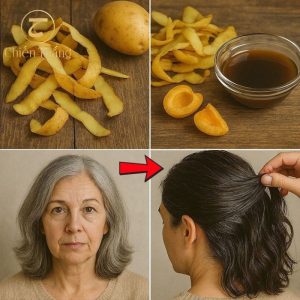 vỏ khoai tây trị tóc bạc