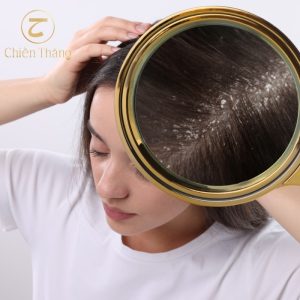 cách trị gàu cho nữ