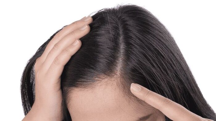 chú trọng chăm sóc da đầu mùa hanh khô