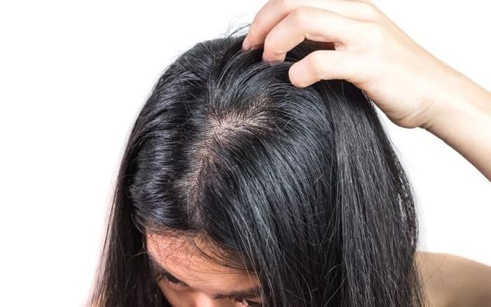 công dụng của trị gàu bằng trứng gà