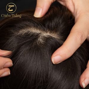 chân tóc bị khô